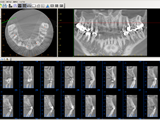 歯科用CT(3D)